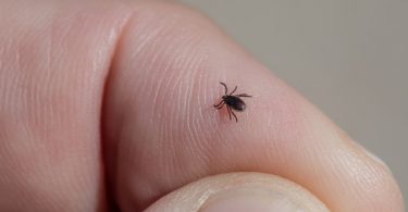 Natural Flea and Tick Remedies